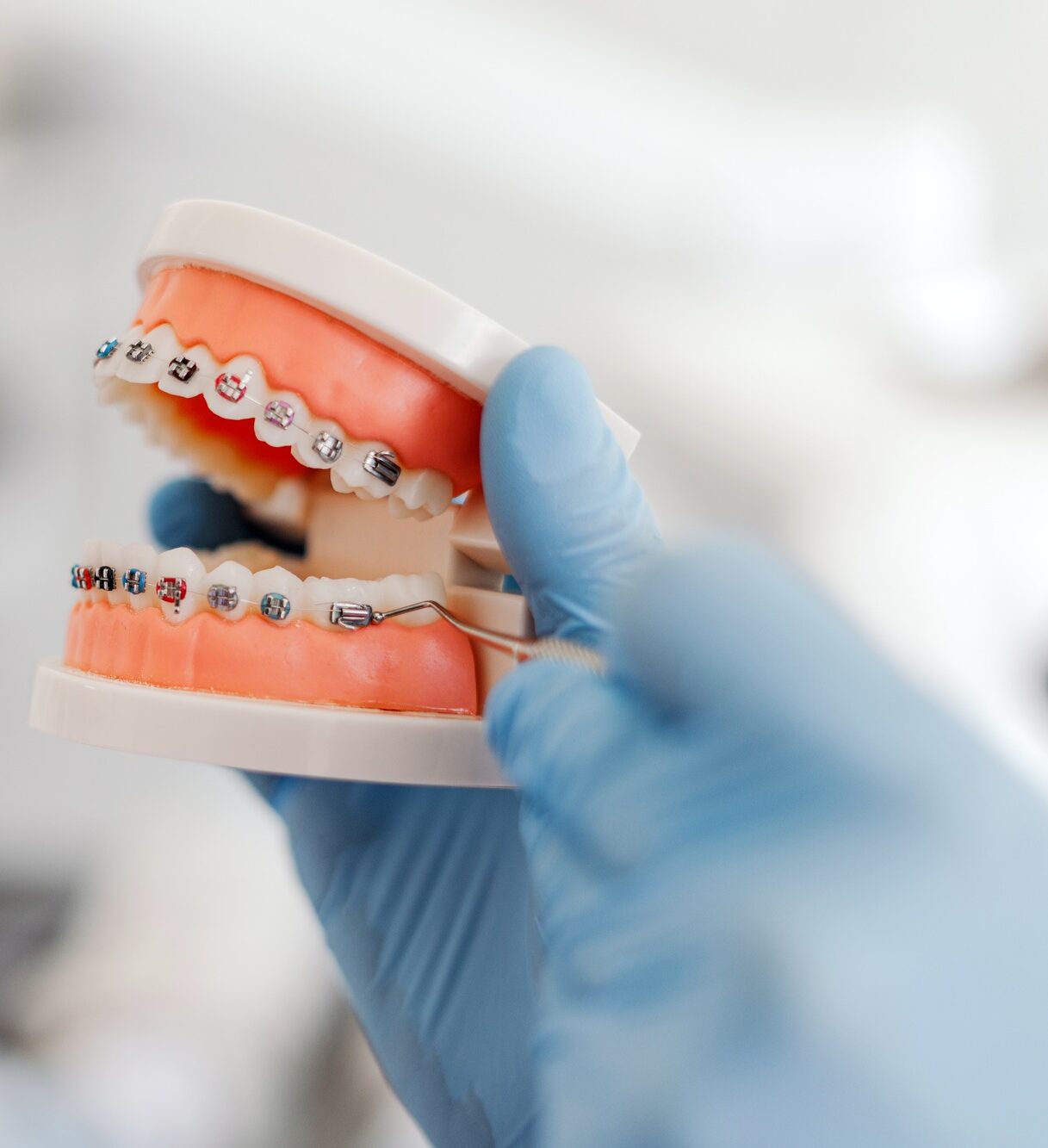 Closeup, dentist holding jaw with braces in his hand. Orthodontic treatment, dental care concept